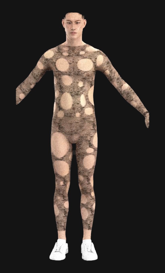 The Damage Suit